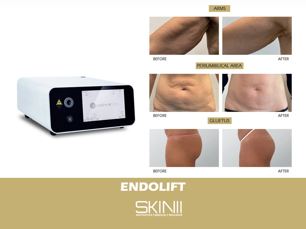 Skin111
